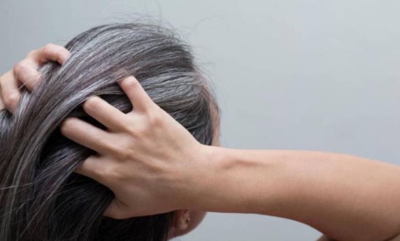 wellhealthorganic.com/know-the-causes-of-white-hair-and-easy-ways-to-prevent-it-naturally